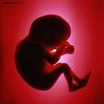 دعوی سقط جنین